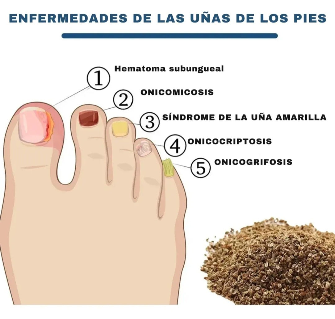 Parches para el tratamiento de la uña amarilla el hongo