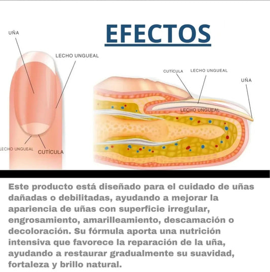 Parches para el tratamiento de la uña amarilla el hongo