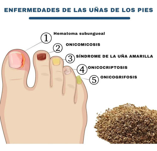 Parches Cuidado De Uñas Amarillas Cura Casera Para Hongos
