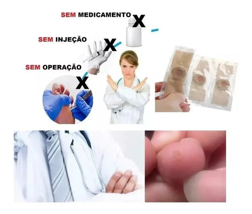Kit De 12 Parches Quita Callos, Verrugas, Ojo De Pez