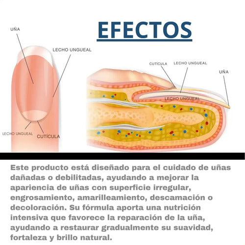 Parches Cuidado De Uñas Amarillas Cura Casera Para Hongos