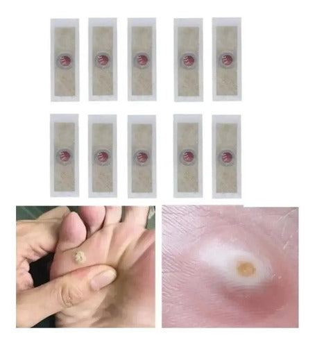 Kit De 12 Parches Quita Callos, Verrugas, Ojo De Pez